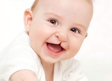 Chupete Especial Silicona Labios Leporinos S